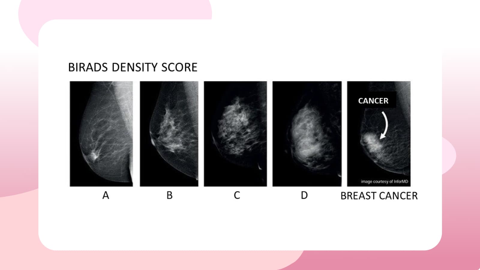 Petition for Standardizing Breast Density Notification Protocols